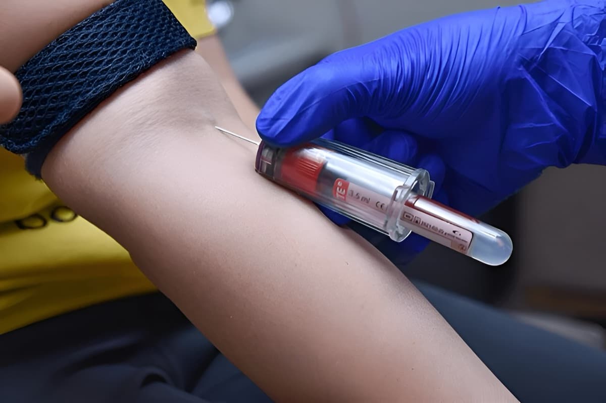 Blood collection at home